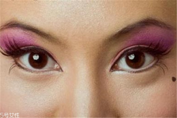 黑痣是怎么形成的？防范黑色毒瘤