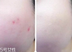 cpb遮瑕棒怎么樣？來看看使用效果