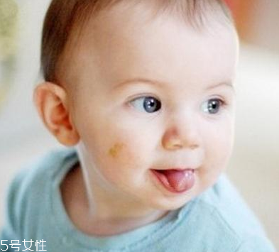 胎記怎么去除？胎記有遺傳的可能