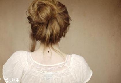 黑痣是怎么形成的？防范黑色毒瘤