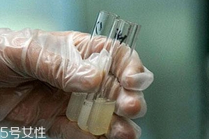 捐精有什么危害？專家稱沒(méi)有危害