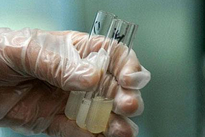 捐精有什么危害？專家稱沒有危害