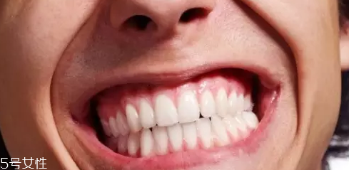 磨牙是因?yàn)槭芰宋?？孩子的心理狀況也會(huì)導(dǎo)致磨牙