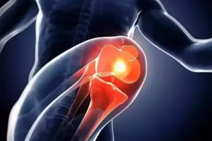 關(guān)節(jié)有響聲是病嗎？兩種情況區(qū)別對待