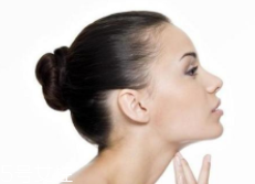 頸紋可以消除嗎？醫(yī)美方法最靠譜