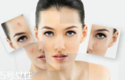 光敏食物真的會(huì)導(dǎo)致變黑嗎？只有敏感皮才要注意