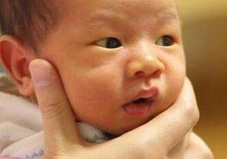 新生兒長黃疸怎么辦？有些黃疸癥狀媽媽們可別忽視