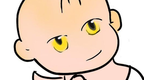 新生兒長黃疸怎么辦？有些黃疸癥狀媽媽們可別忽視