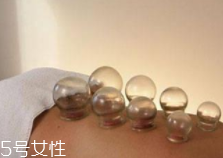 拔火罐引火上身的原因是什么？這4點(diǎn)要注意