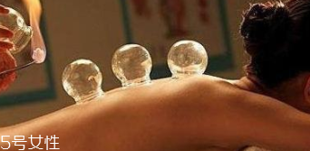 拔火罐引火上身的原因是什么？這4點(diǎn)要注意