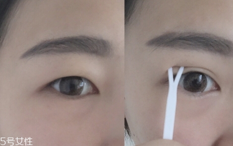 雙眼皮貼可以過(guò)夜嗎？不建議晚上貼