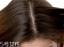 油性頭發(fā)跟什么有關？離不了這6個原因