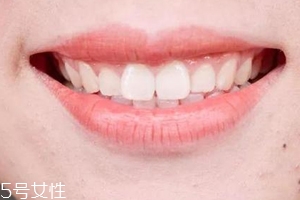 口紅病有哪些癥狀？使用不當(dāng)引發(fā)癌癥