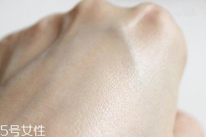 白癜風與身體免疫功能有關系嗎？兩者關系密切