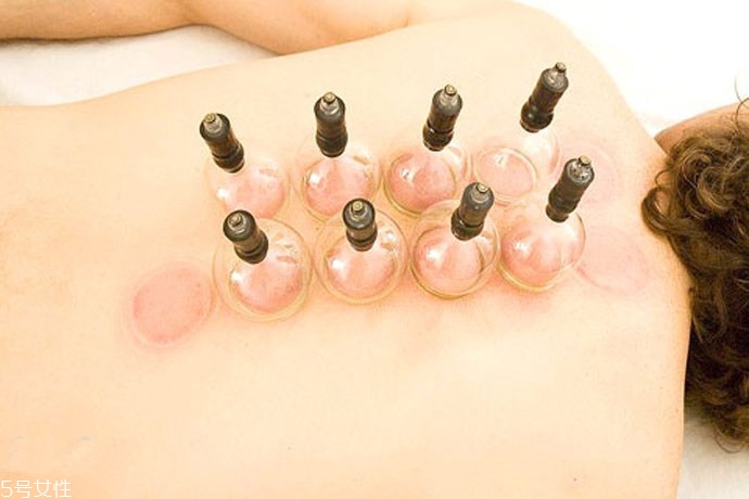 拔罐后身上后背持續(xù)發(fā)癢怎么回事？體內(nèi)風(fēng)邪是主因