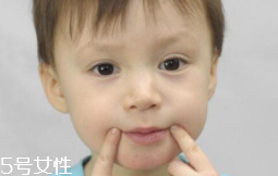 冬天爛嘴角什么原因？有可能營(yíng)養(yǎng)不良