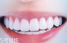 牙線和漱口水是否必要？抑菌護牙好習(xí)慣