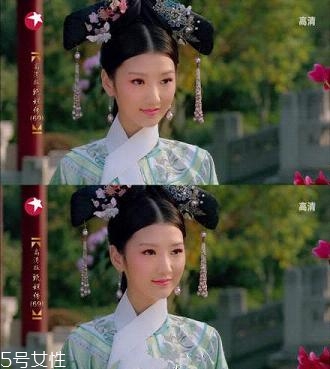 開(kāi)眼角疤痕多久消失？開(kāi)眼角的適宜人群