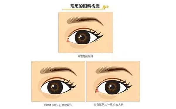開外眼角和開內(nèi)眼角哪個(gè)好？開眼角有可能會(huì)回縮