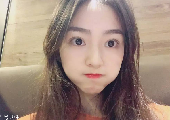 割雙眼皮要注意什么？割雙眼皮充血是正?，F(xiàn)象