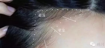 眉粉可以當(dāng)發(fā)際線粉嗎？解救高發(fā)際線的技巧