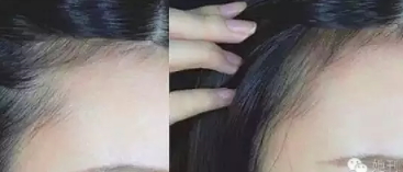 眉粉可以當(dāng)發(fā)際線粉嗎？解救高發(fā)際線的技巧