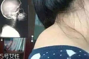 富貴包是什么??？姿態(tài)優(yōu)美少犯病