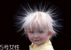 少年白什么原因？焦慮緊張會得病