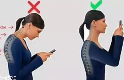 脖子有聲響是什么?。靠赡苁顷P(guān)節(jié)炎