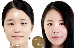 蕾絲雙眼皮貼好用嗎？蕾絲雙眼皮貼教程