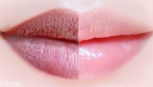 唇膏可以祛痘嗎？小心致痘風(fēng)險(xiǎn)