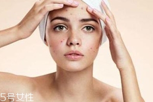 痘痘反復(fù)長是什么原因？基礎(chǔ)護膚不夠用心