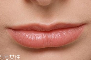 嘴唇干裂是一種病嗎？治療口角炎從改善習慣入手
