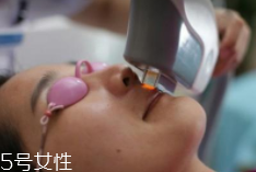 科技脫毛有哪些種類？冰點(diǎn)脫毛不毀毛囊