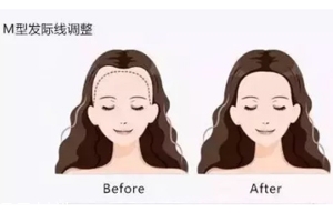 發(fā)際線粉填充和發(fā)際線筆哪個好？配合使用才最完美