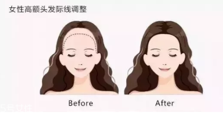 發(fā)際線粉填充和發(fā)際線筆哪個(gè)好？配合使用才最完美