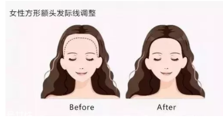 發(fā)際線粉填充和發(fā)際線筆哪個(gè)好？配合使用才最完美