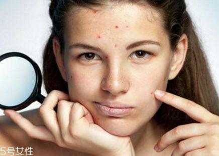 激光去痘印會留疤嗎？不規(guī)范操作肯定會有疤