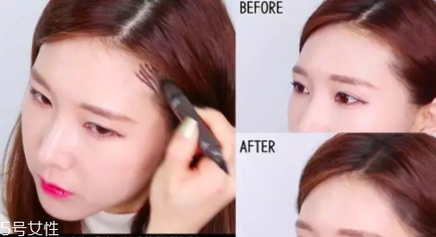 發(fā)際線高怎么治？拯救發(fā)際線攻略