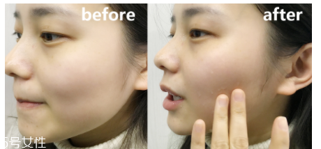 蘭蔻粉水適合什么年齡？只針對年輕肌底