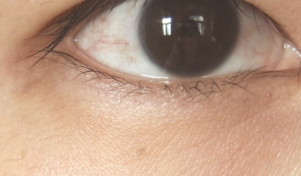 雅詩(shī)蘭黛適合敏感肌嗎？