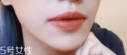 怎么變成櫻桃小嘴？大嘴唇變小攻略