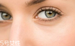 黑眼圈很重是什么原因？深扒三類黑眼圈的成因