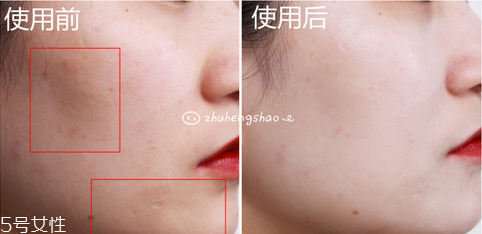 蘭芝小白光氣墊bb霜使用方法 水光透白的自然妝感 蘭芝小白光氣墊bb霜使用方法 水光透白的自然妝感