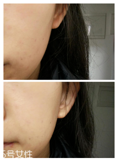 snail white蝸牛霜怎么打開？輕輕一按即有乳液滲出