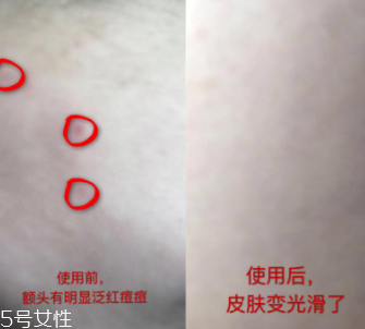 資生堂紅腰子適合什么年齡？最適合30歲以下人群