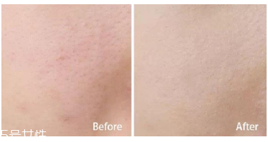 妮維雅小藍罐很油嗎？清爽不油膩