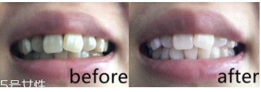 美白牙膏有用嗎？中華魔麗迅白牙膏評測