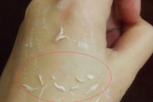 去角質(zhì)凝露多久用一次？皮厚一周一次