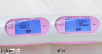 sk2神仙水適合油皮嗎？油皮親媽